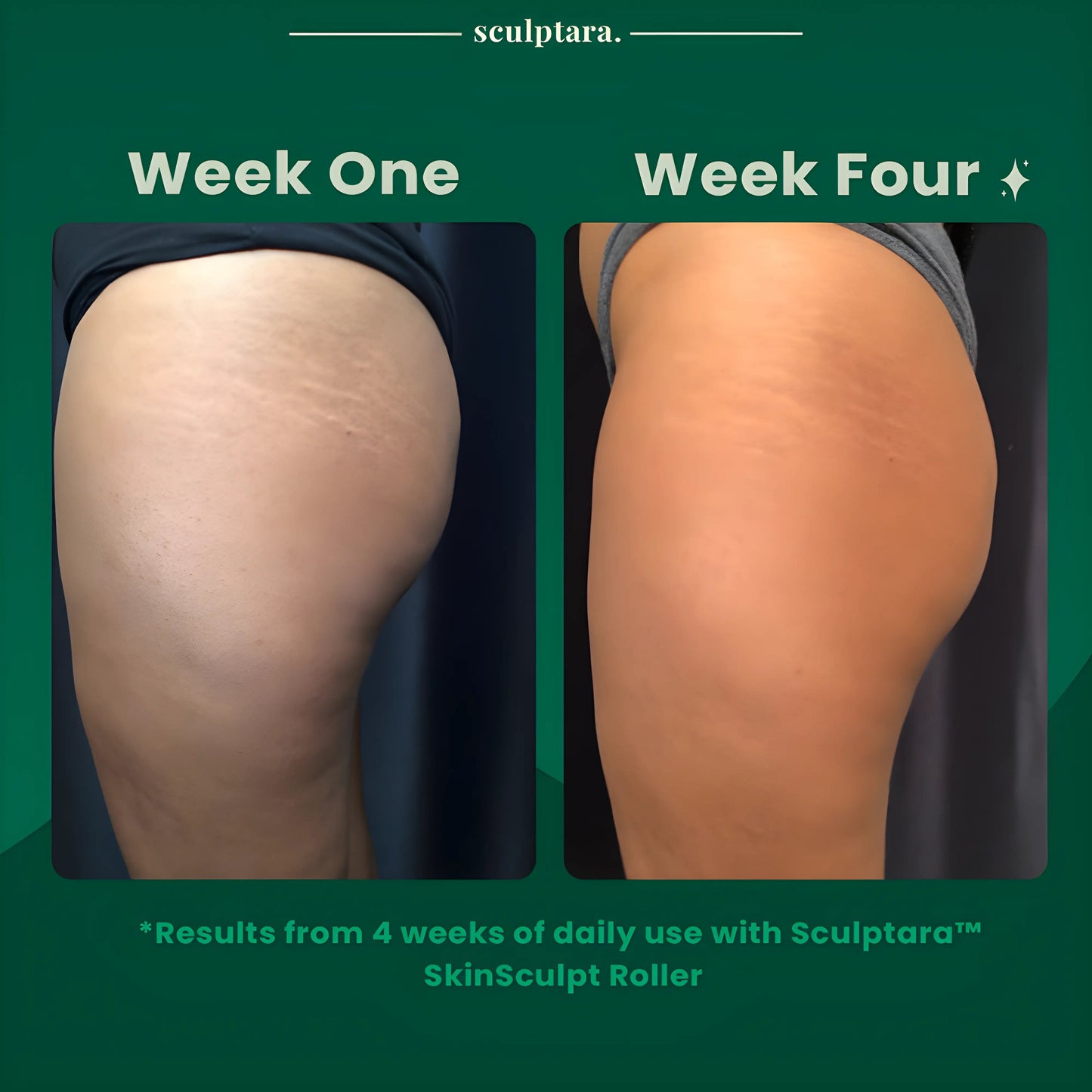 SkinSculpt Roller