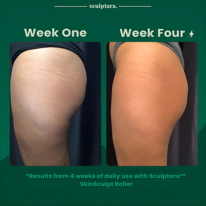 SkinSculpt Roller